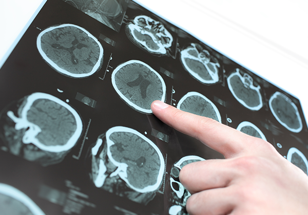 02.神経内科専門医による専門外来